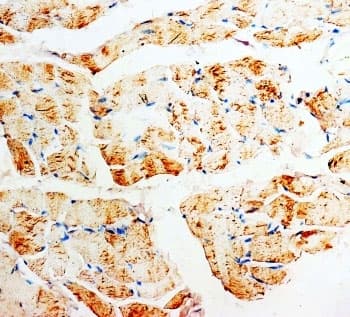Polyclonal Rabbit anti-Human PMVK Antibody (aa135-151, IHC, WB)