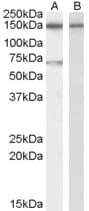 Polyclonal Goat anti-Human ACHE / Acetylcholinesterase Antibody (aa601-614, IF, WB)