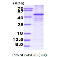 Human RASSF1 / RASSF1A Protein (Recombinant His)
