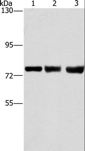 Polyclonal Rabbit anti-Human GGCX Antibody (IHC, WB)