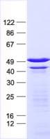 Human VRK1 Protein (Recombinant His, N-Terminal)