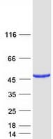 Human CATIP / C2orf62 Protein (Recombinant Myc-DDK (Flag))