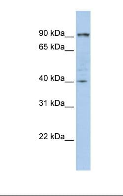 GPBB / PYGB Antibody (aa72-121)