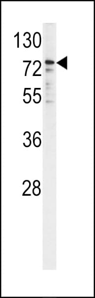 CYPOR / POR Antibody (aa462-488)