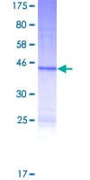 Human Putative g6 protein (gr6) (Recombinant GST)