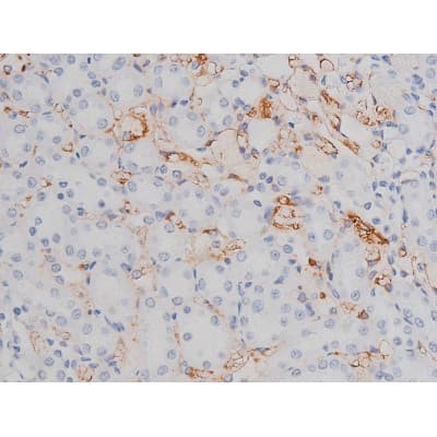 Polyclonal Rabbit anti-Human MAPT / Tau Antibody (phospho-Thr205, IHC, WB)