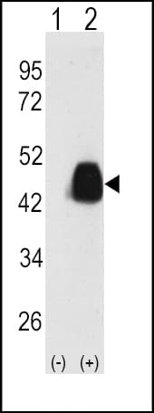 IHC-plus™ PDHX / Protein X / ProX Antibody (Thr11)
