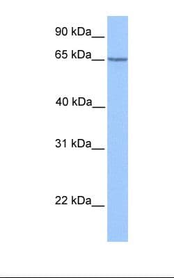 PML Antibody (aa588-637)