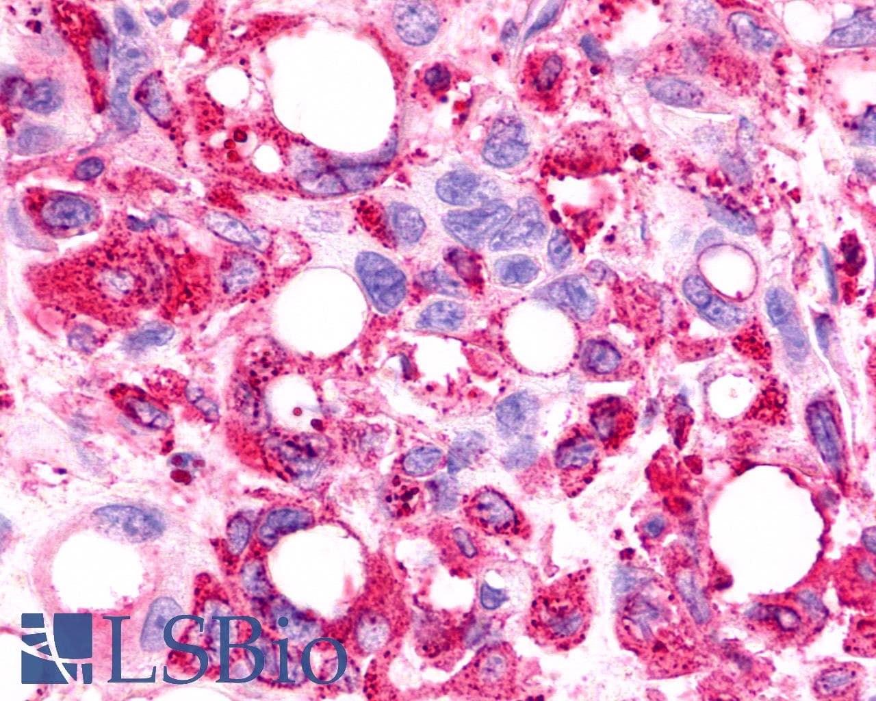 PathPlus™ TPRA1 / GPR175 Antibody (Cytoplasmic Domain)