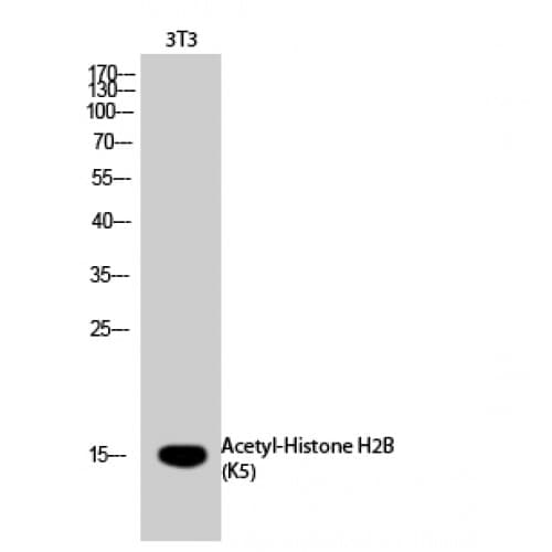 Histone H2B Antibody (1-80 aa)