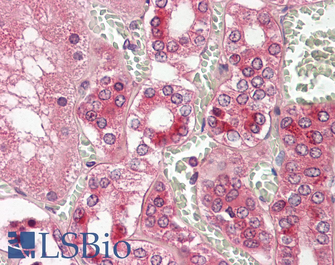 IHC-plus™ CTSV / Cathepsin V Antibody