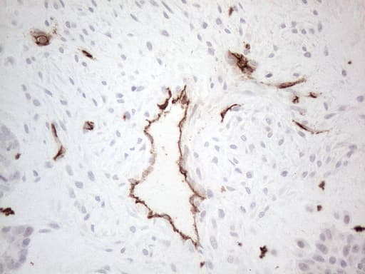 CD34 Antibody (aa312-385, clone OTI11E1)