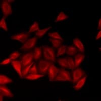 CRHBP Antibody