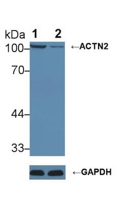 ACTN2 Antibody (aa1-254)