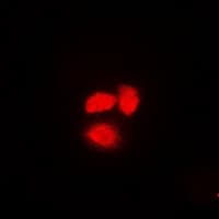 XPO5 / Exportin 5 Antibody