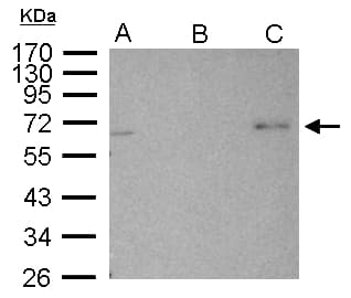 Polyclonal Rabbit anti-Human PRKAA2 / AMPK Alpha 2 Antibody (aa29-510, IHC, WB)