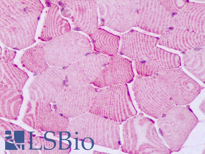 IHC-plus™ PTPRA / RPTP-Alpha Antibody (Cytoplasmic Domain)