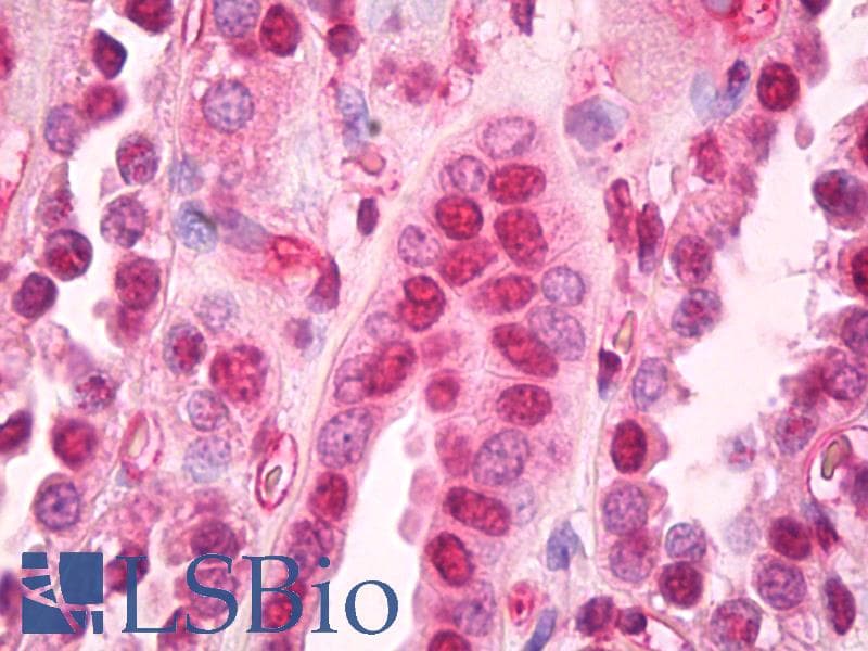 IHC-plus™ Monoclonal Mouse anti-Human B2M / Beta 2 Microglobulin Antibody (clone 3F9-2C2, IHC, IF, WB)