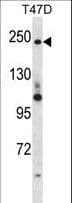 PPL / Periplakin Antibody (aa1301-1330)