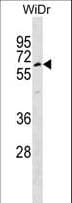 TULP1 Antibody (aa184-211)