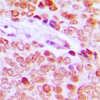 Histone H2B Antibody (N-Terminus)