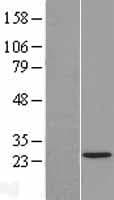 TAF11 Protein (Over-Expression Lysate Myc-DDK (Flag))