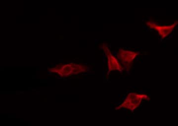 CHUK / IKKA / IKK Alpha Antibody (phospho-Thr23)