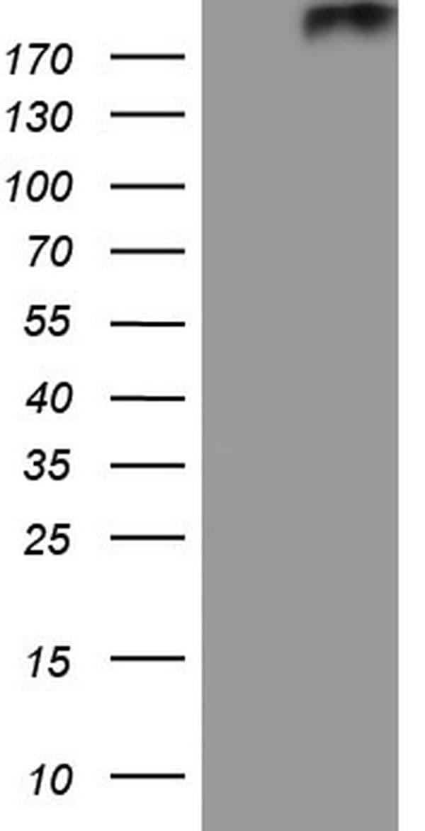 PTCH2 / Patched 2 Antibody (aa79-392, clone OTI8B5)