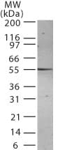 Monoclonal Mouse anti-Human PSEN2 / Presenilin 2 Antibody (clone 198C679.2., WB)