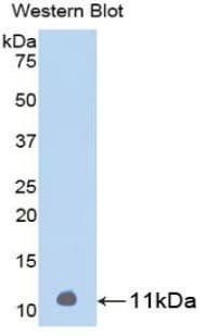 PTH / Parathyroid Hormone Antibody (aa31-115)