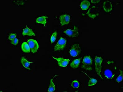 IHC-plus™ KRT10 / CK10 / Cytokeratin 10 Antibody (aa1-584)