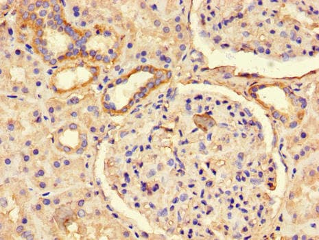 Polyclonal Rabbit anti-Human DEPDC2 Antibody (IHC, IF, WB)