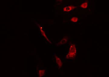 SH2D2A Antibody