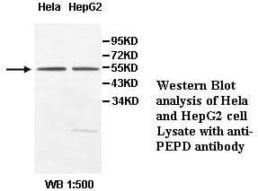 PEPD / PROLIDASE Antibody (aa22-290)
