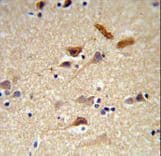 NPTX1 Antibody (aa322-350)