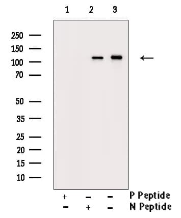 SREBF1 / SREBP-1 Antibody (phospho-Ser439)