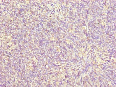 ZNF131 Antibody
