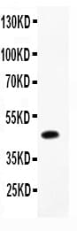CMA1 / Mast Cell Chymase Antibody (aa22-247)