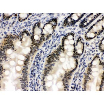 OGT / O-GLCNAC Antibody (aa1008-1046)