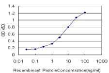 SLC26A4 / Pendrin Antibody (clone 3D2)