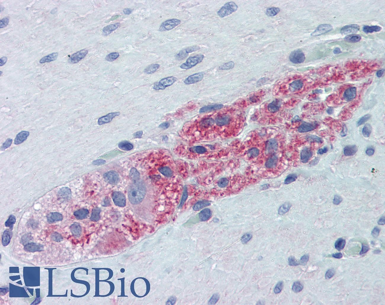 IHC-plus™ RPS6KB1 / P70S6K / S6K Antibody (clone 1E12)