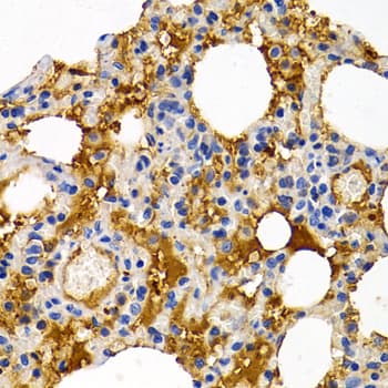 TFF1 / pS2 Antibody