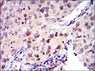 MCM2 Antibody (clone 2B3)