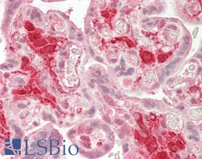 IHC-plus™ ADAM9 Antibody (aa400-450)