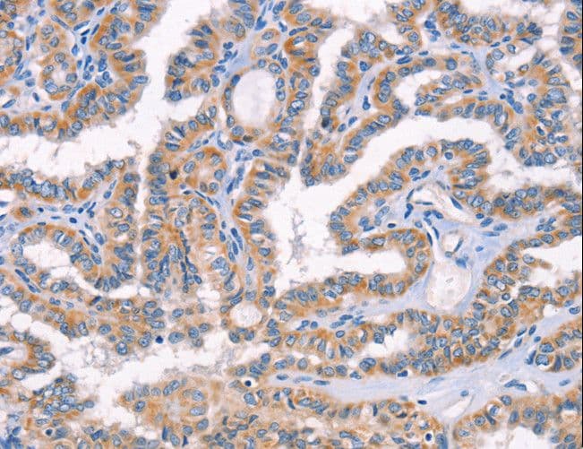 AP1B1 / BAM22 Antibody