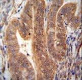 Polyclonal Rabbit anti-Human KIAA1644 Antibody (aa18-46, IHC, WB)