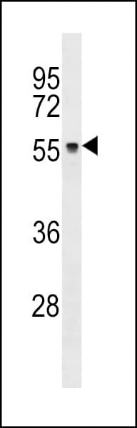 Polyclonal Rabbit anti-Human ZNF737 Antibody (aa86-112, WB)