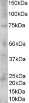 Polyclonal Goat anti-Human PMEL / SILV / gp100 Antibody (aa647-660, WB)