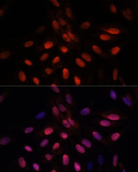 TPI1 / TPI Antibody