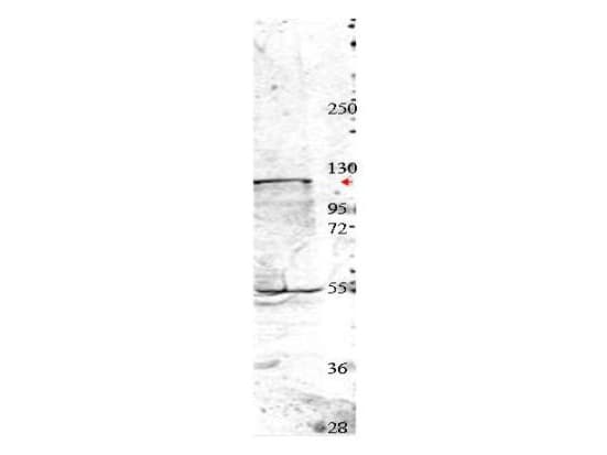Polyclonal Rabbit anti-Human NEDD4 Antibody (Internal, IF, WB)